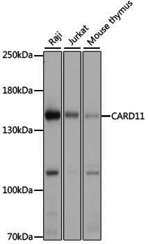 Anti-CARD11 Rabbit pAb