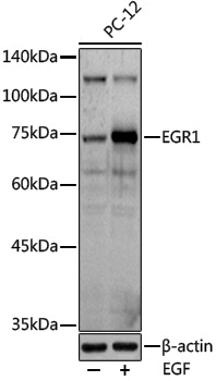 Anti-EGR1 Rabbit pAb