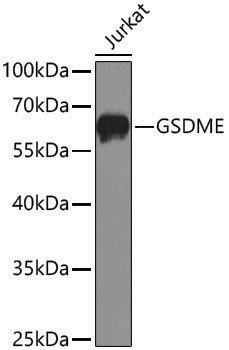 Anti-GSDME Rabbit pAb