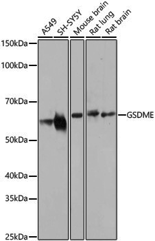 Anti-GSDME Rabbit pAb
