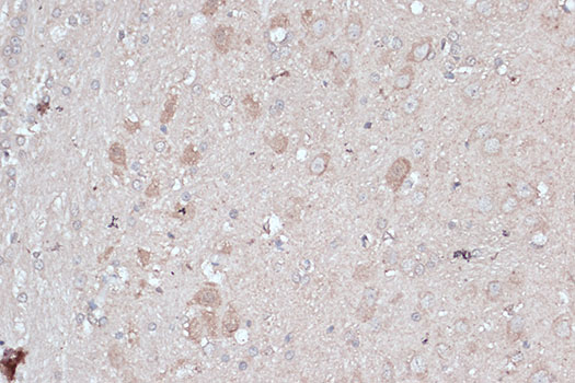 [KD Validated] Anti-LC3B Rabbit pAb