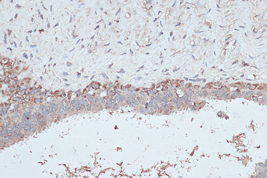 [KD Validated] Anti-LC3B Rabbit pAb