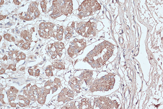 [KD Validated] Anti-LC3B Rabbit pAb