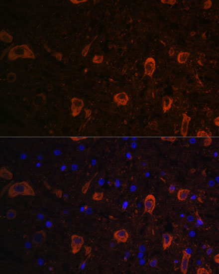 [KD Validated] Anti-LC3B Rabbit pAb