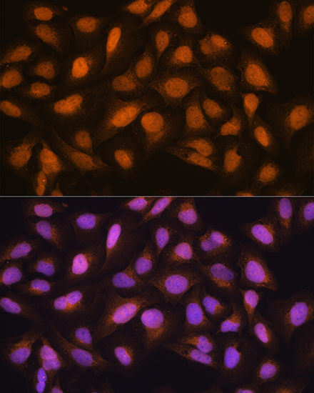 Anti-SKP2 Rabbit pAb