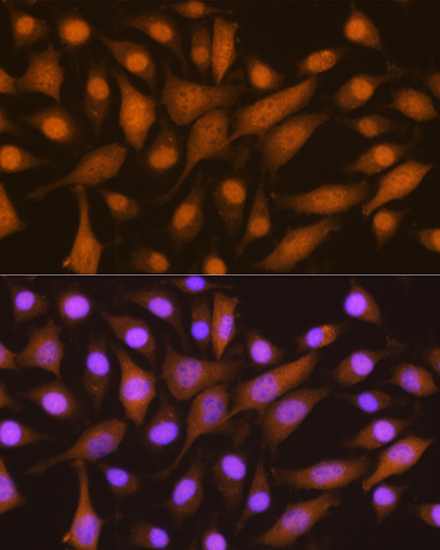 Anti-SKP2 Rabbit pAb