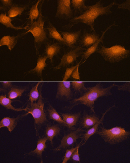 Anti-SKP2 Rabbit pAb