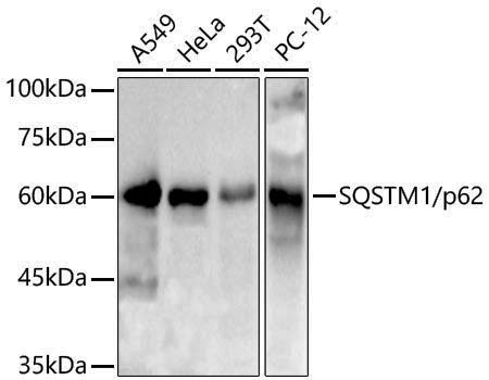 Anti-SQSTM1/p62 Rabbit pAb