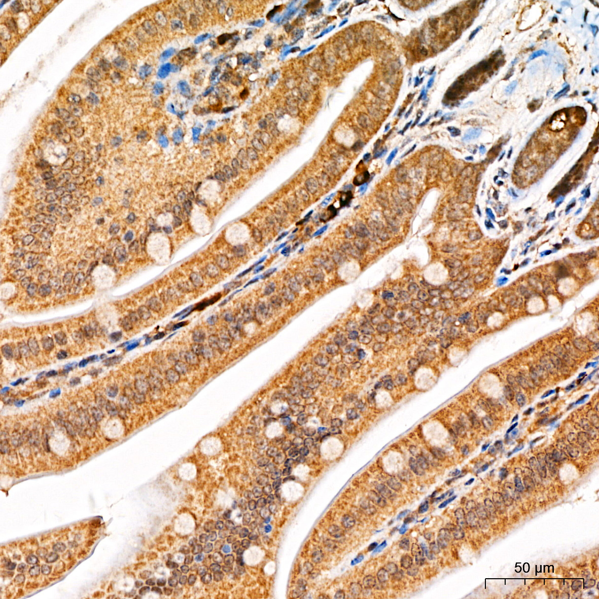 Anti-Beclin 1 Rabbit pAb