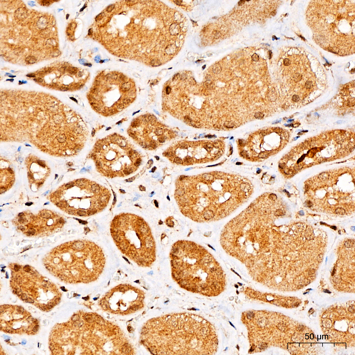 Anti-Beclin 1 Rabbit pAb