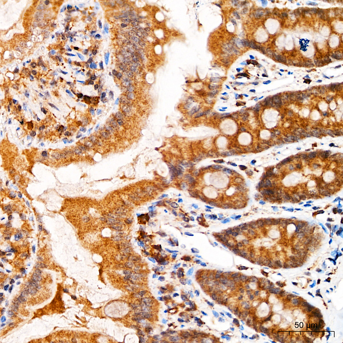 Anti-Beclin 1 Rabbit pAb