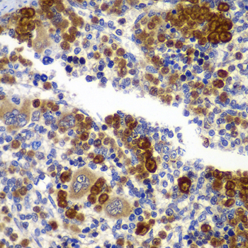 Anti-AMPK beta 1 Rabbit pAb