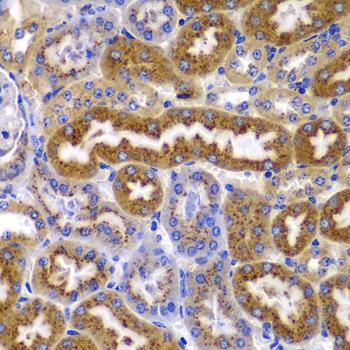 Anti-AMPK beta 1 Rabbit pAb