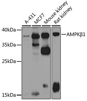 Anti-AMPK beta 1 Rabbit pAb