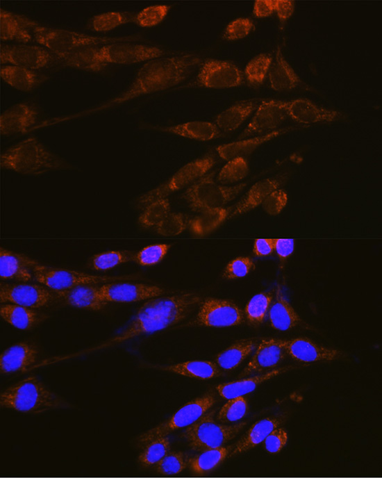 Anti-Dynamin 2 Rabbit pAb