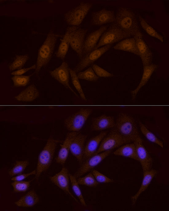 Anti-Chk1 Rabbit pAb