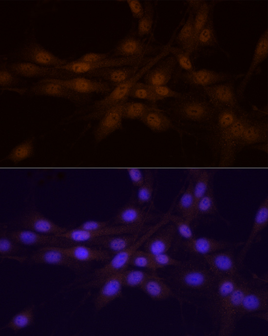 Anti-Chk1 Rabbit pAb
