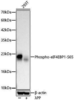 Anti-Phospho-4E-BP1 (Ser65) Rabbit pAb