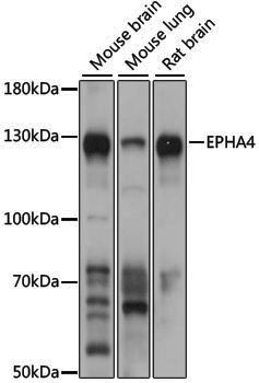 Anti-EPHA4 Rabbit pAb