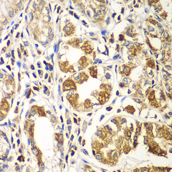 Anti-Rac1/2/3 Rabbit pAb