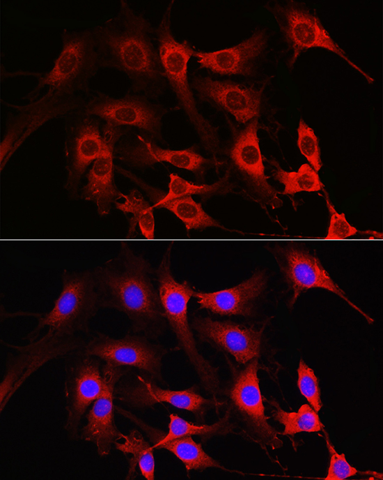 Anti-Rac1/2/3 Rabbit pAb