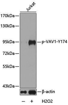 Anti-Phospho-VAV1 (Tyr174) Rabbit pAb