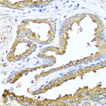 Anti-NCK2 Rabbit pAb