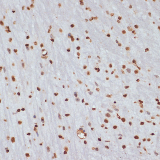 Anti-Phospho-Chk1 (Ser280) Rabbit pAb
