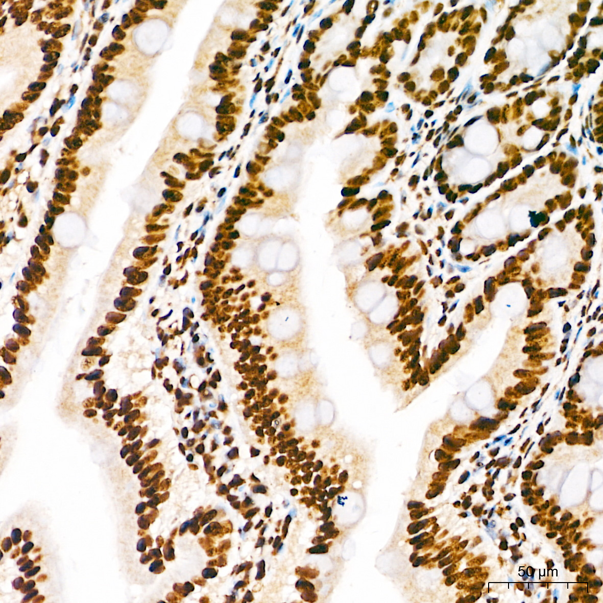 Anti-Phospho-ELK1 (Ser383) Rabbit pAb