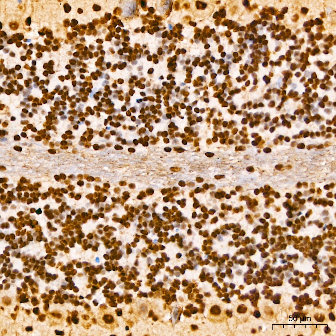 Anti-Phospho-ELK1 (Ser383) Rabbit pAb