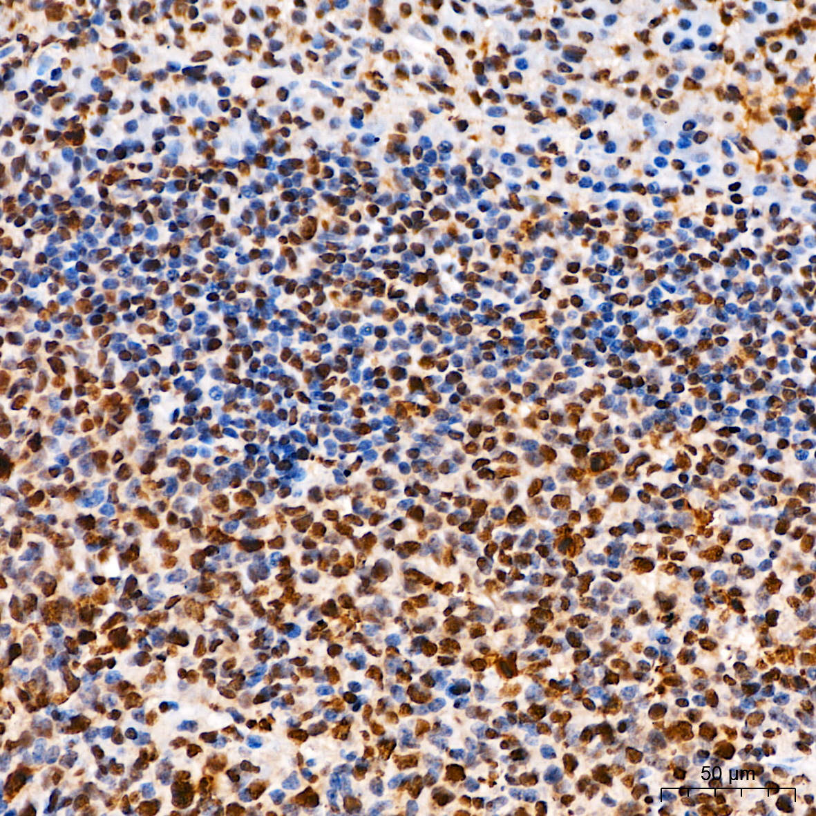 Anti-Phospho-ELK1 (Ser383) Rabbit pAb