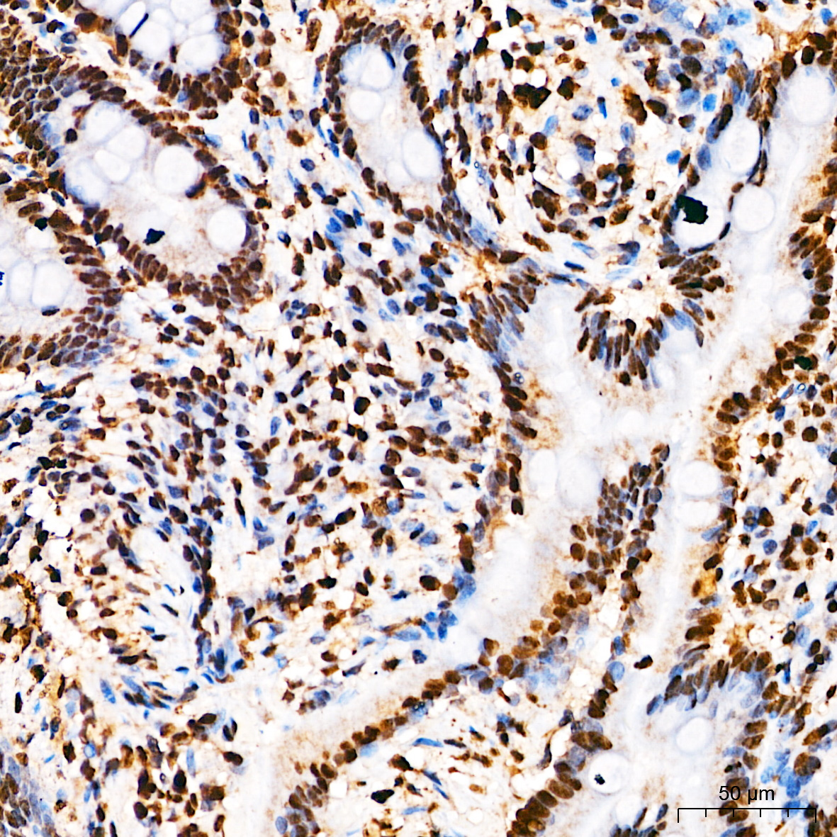 Anti-Phospho-ELK1 (Ser383) Rabbit pAb