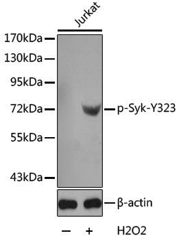 Anti-Phospho-Syk (Tyr323) Rabbit pAb