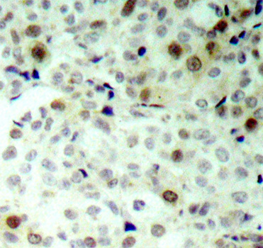 Anti-Phospho-CDK2 (Thr160) Rabbit pAb