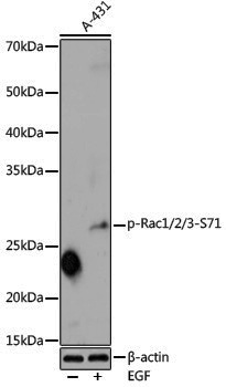 Anti-Phospho-Rac1/2/3 (Ser71) Rabbit pAb