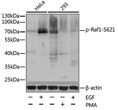 Anti-Phospho-Raf1 (Ser621) Rabbit pAb