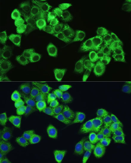 Anti-Phospho-mTOR (Ser2448) Rabbit pAb