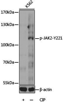 Anti-Phospho-JAK2 (Tyr221) Rabbit pAb