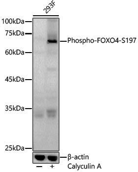 Anti-Phospho-FOXO4 (Ser197) Rabbit pAb