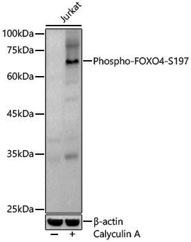 Anti-Phospho-FOXO4 (Ser197) Rabbit pAb