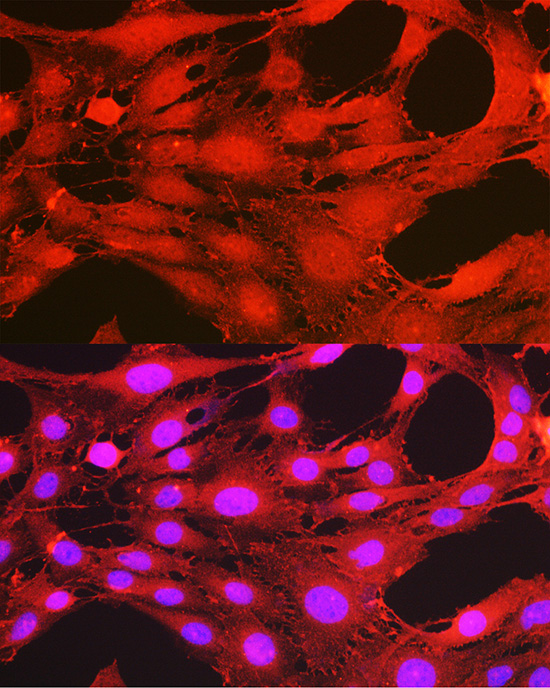 Anti-Phospho-PDPK1 (Ser241) Rabbit pAb