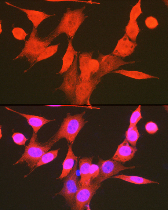 Anti-Phospho-PDPK1 (Ser241) Rabbit pAb