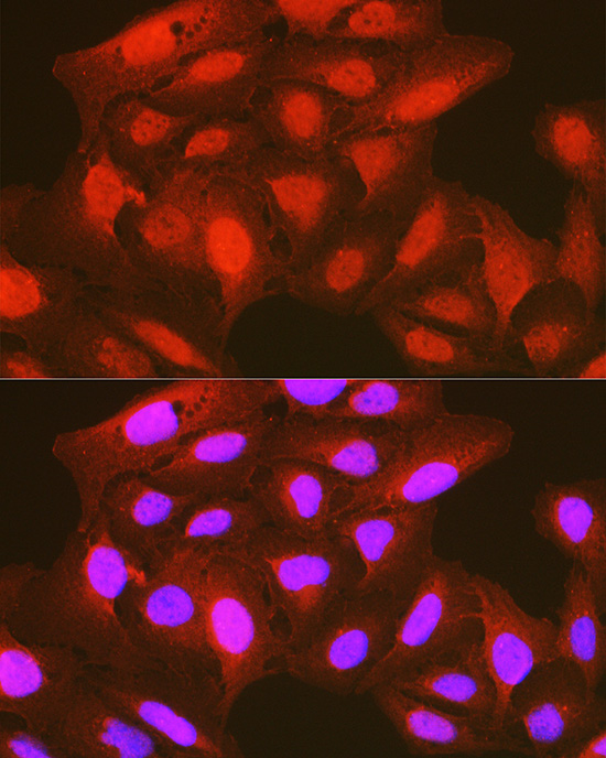 Anti-Phospho-PDPK1 (Ser241) Rabbit pAb