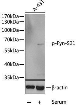 Anti-Phospho-Fyn (Ser21) Rabbit pAb