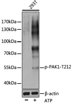 Anti-Phospho-PAK1 (Thr212) Rabbit pAb