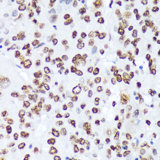 Anti-Phospho-ABL1 (Tyr245) Rabbit pAb