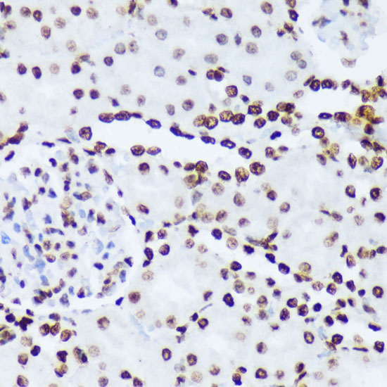 Anti-Phospho-ABL1 (Tyr245) Rabbit pAb