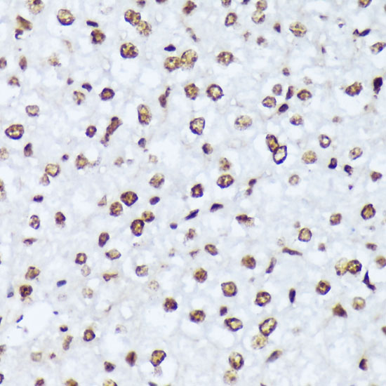 Anti-Phospho-ABL1 (Tyr245) Rabbit pAb