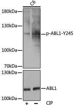 Anti-Phospho-ABL1 (Tyr245) Rabbit pAb