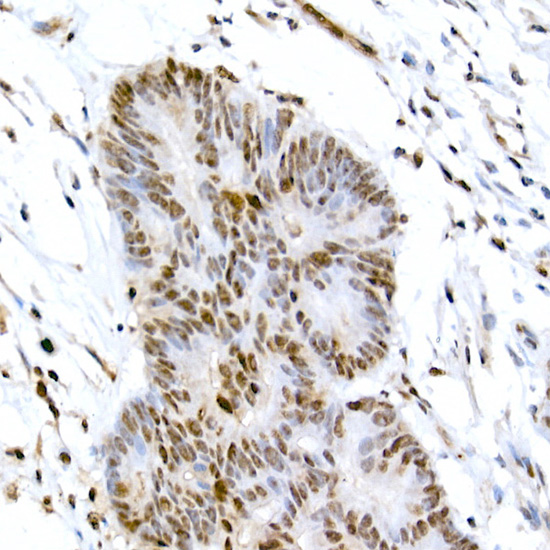 Anti-Phospho-CREB1 (Ser133) Rabbit pAb